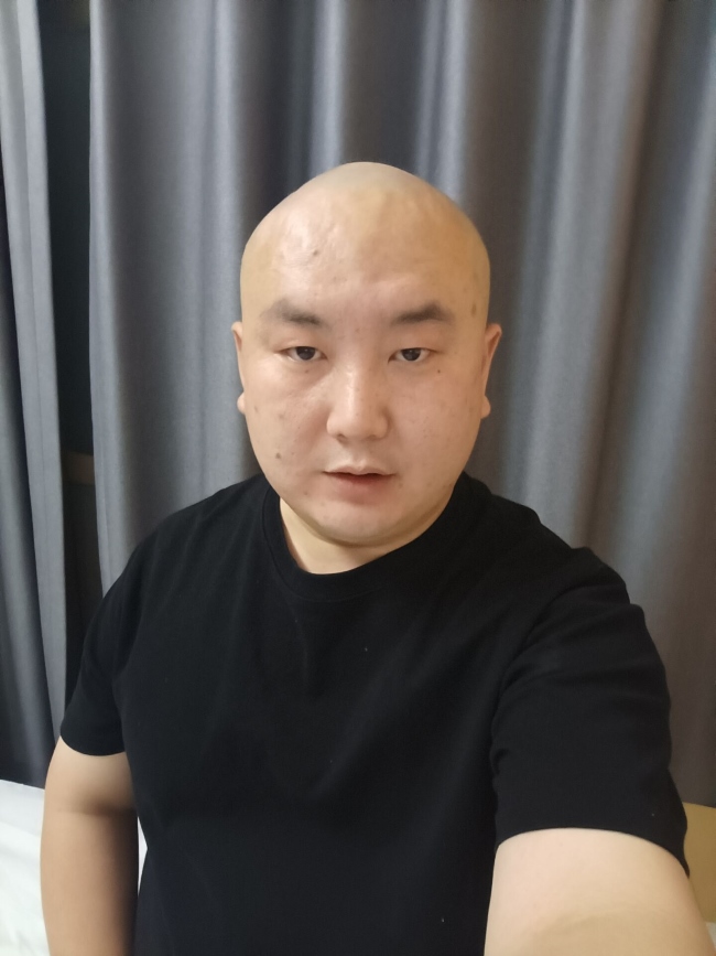 ũ